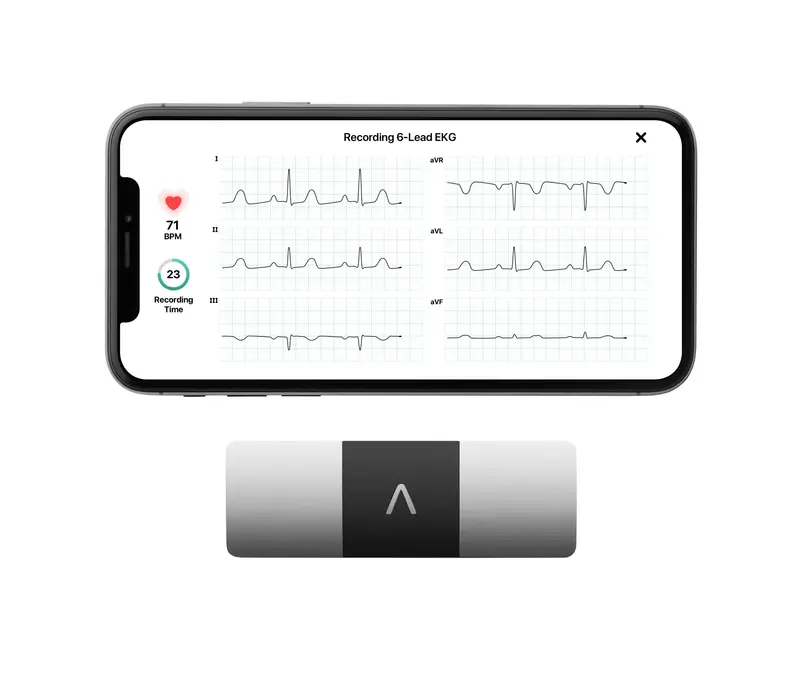 KardiaMobile 6L Personal EKG Device – FDA-Cleared 6-Lead Heart Monitor for Smartphone Integration